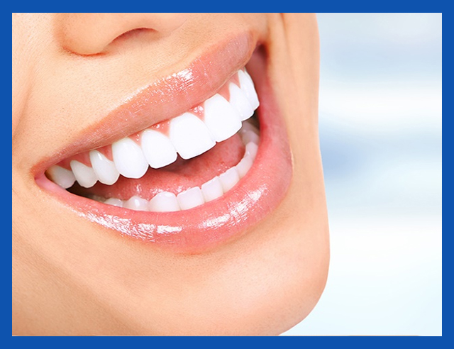 service, cosmetic dentist, Smile Designing,right image