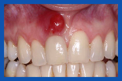 services, Oral Cysts & Tumors, 1st left image
