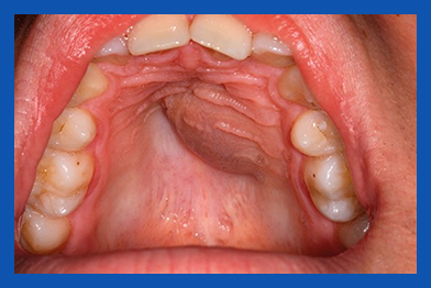 services, Oral Cysts & Tumors, 2st right image